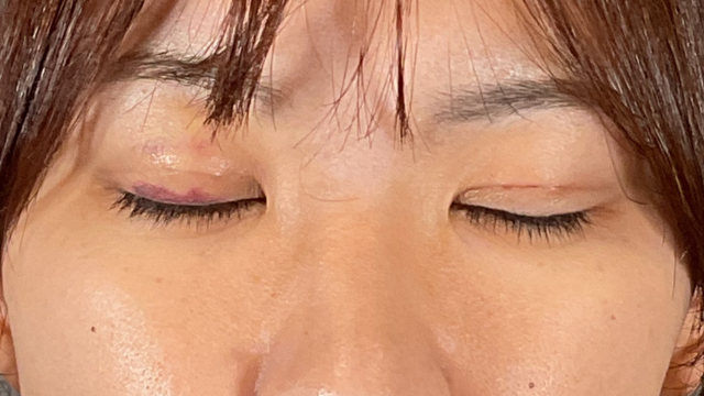 手术前的状态 其一