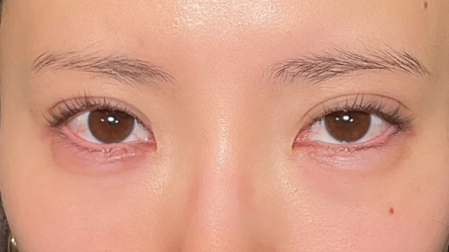 手术前的状态 其一