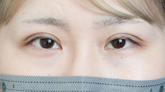 手术前的状态 其一