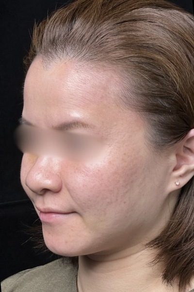 手術前の状態 その1