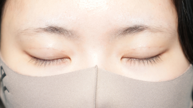 手术前的状态 其一