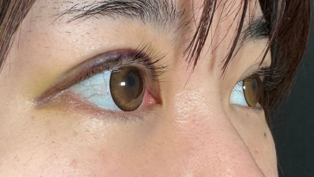 手术前的状态 其一