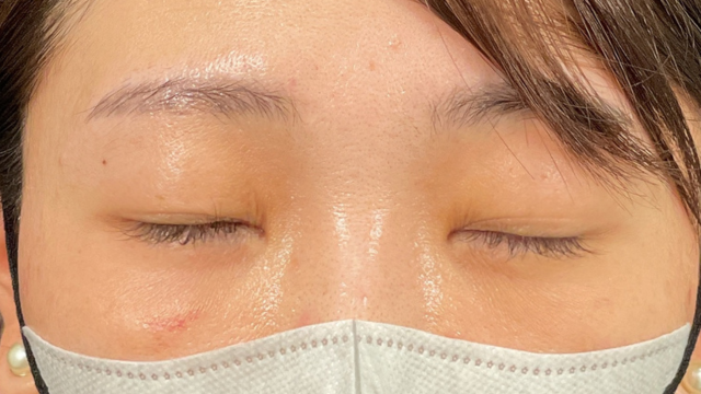 Postoperative Condition Part 1