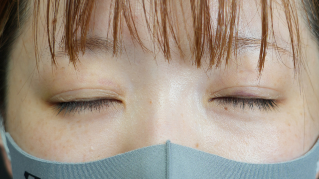 手术前的状态 其一