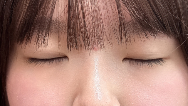 手术前的状态 其一