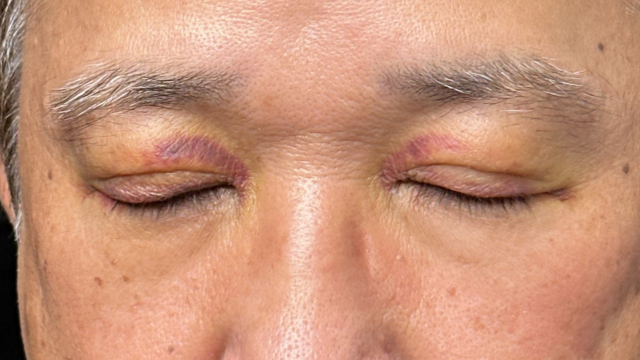 手术前的状态 其一