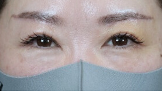 Postoperative Condition Part 1