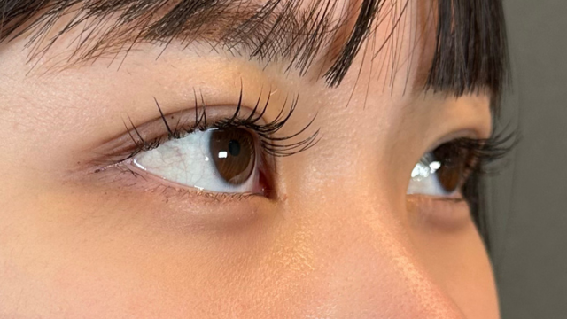 手術前の状態 その1