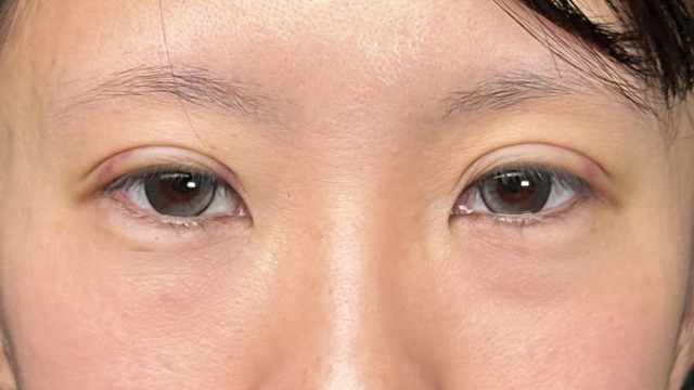 手术前的状态 其一