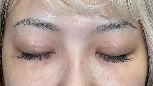 手术前的状态 其一