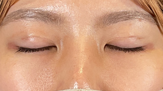 手術前の状態 その1