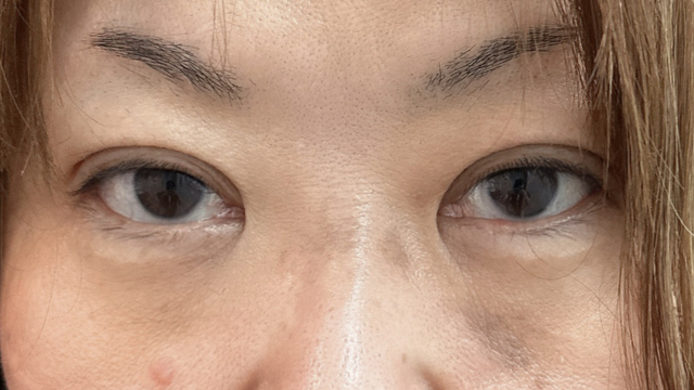 手术前的状态 其一