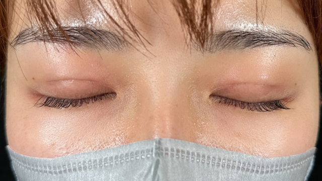 手术前的状态 其一