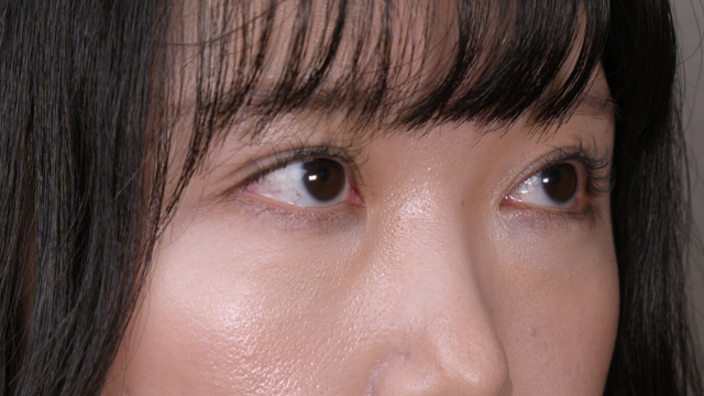 手术前的状态 其一