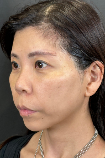 手术前的状态 其一