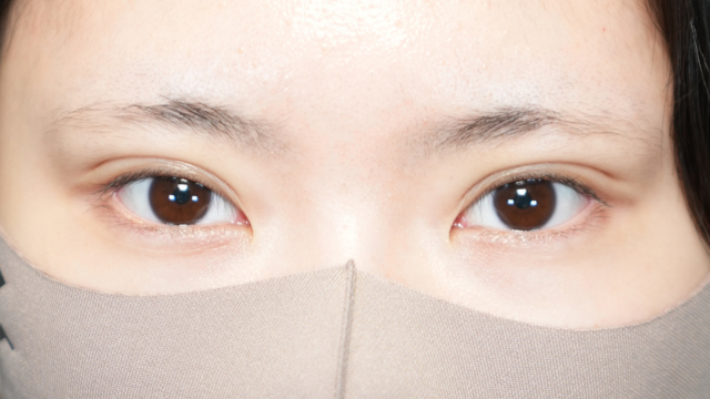 手术前的状态 其一