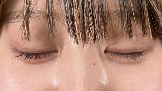 手術前の状態 その1