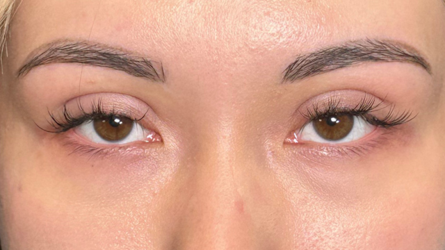 手术前的状态 其一