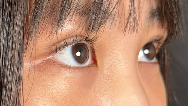 手术前的状态 其一