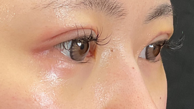 手术前的状态 其一