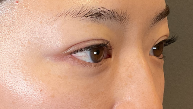 手术前的状态 其一