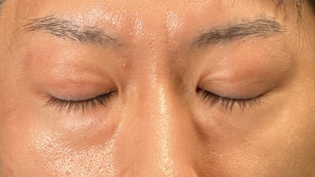 手术前的状态 其一