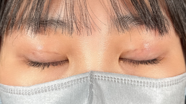 手术前的状态 其一