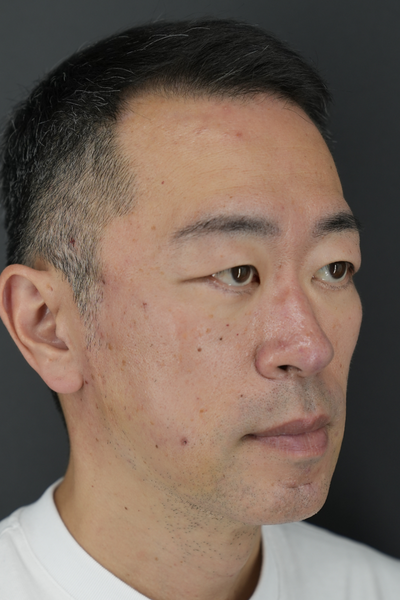 手術前の状態 その1