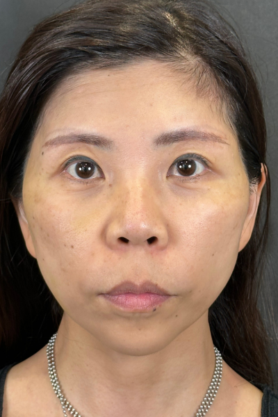 手术前的状态 其一