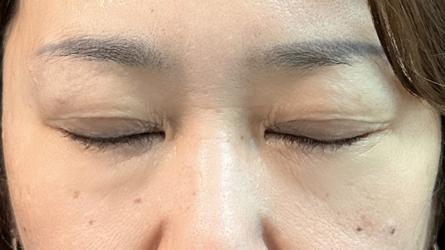 Postoperative Condition Part 1