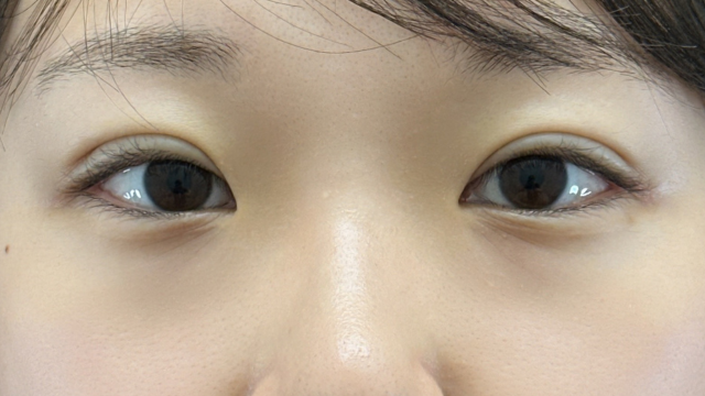 手术前的状态 其一