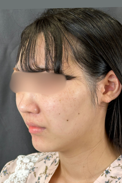 手術前の状態 その1