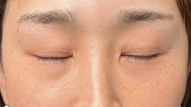 手术前的状态 其一