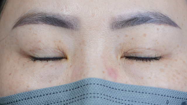 Postoperative Condition Part 1