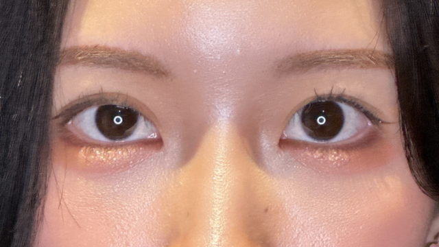 手术前的状态 其一