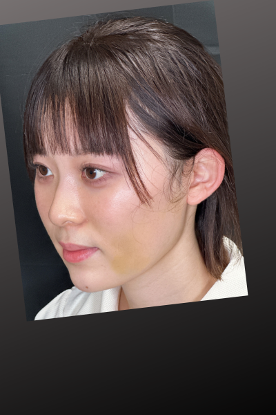 手術前の状態 その1