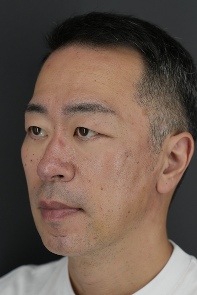 手術前の状態 その1