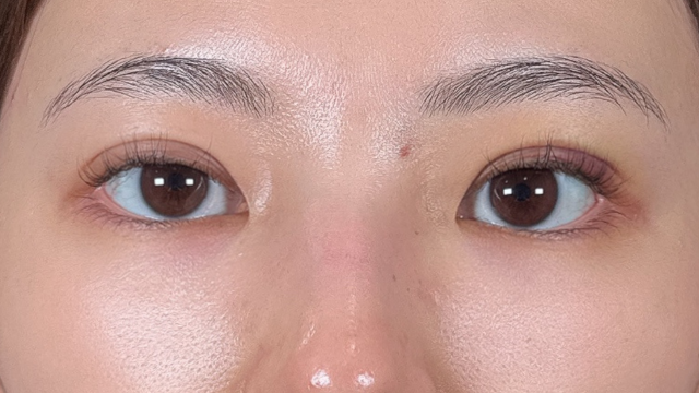 Postoperative Condition Part 1