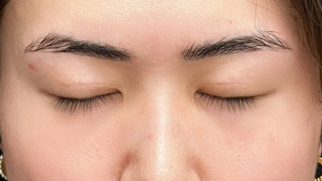 手術前の状態 その1