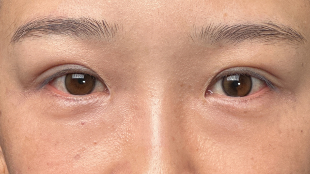 手术前的状态 其一