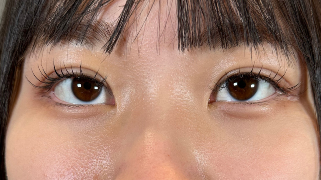 手術前の状態 その1