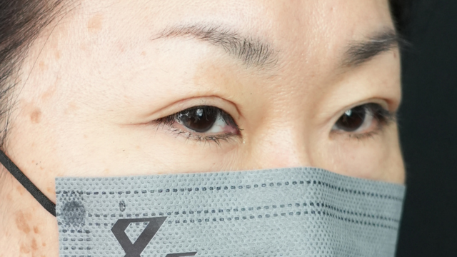 手術前の状態 その1