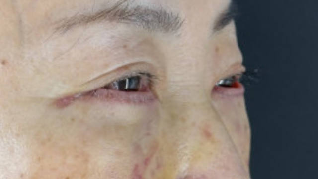 Postoperative Condition Part 1