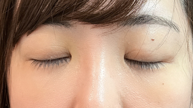 手术前的状态 其一