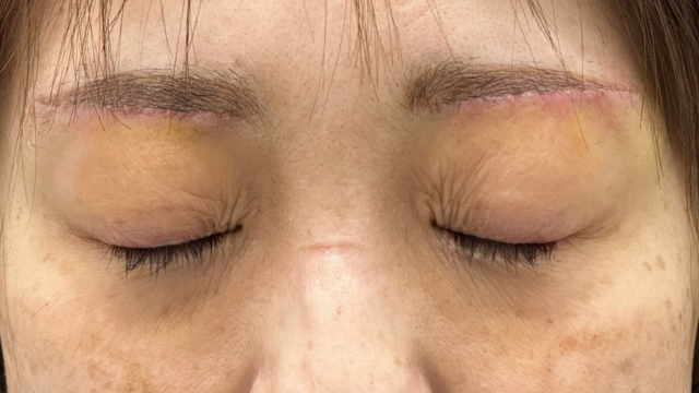 Postoperative Condition Part 1