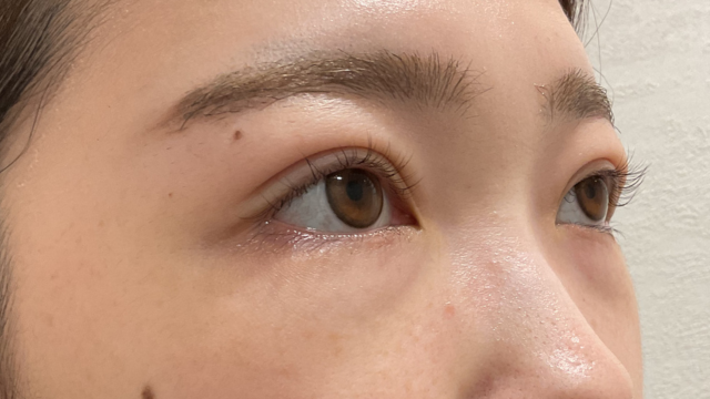 Postoperative Condition Part 1