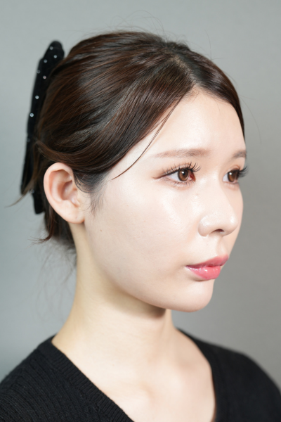 手術前の状態 その1