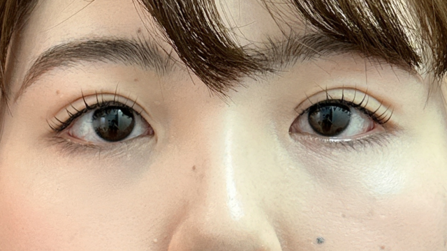 Postoperative Condition Part 1