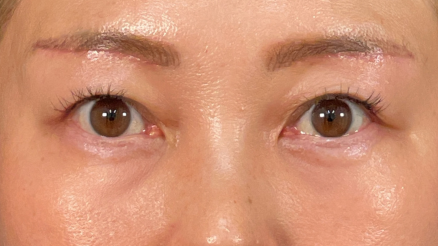 Postoperative Condition Part 1