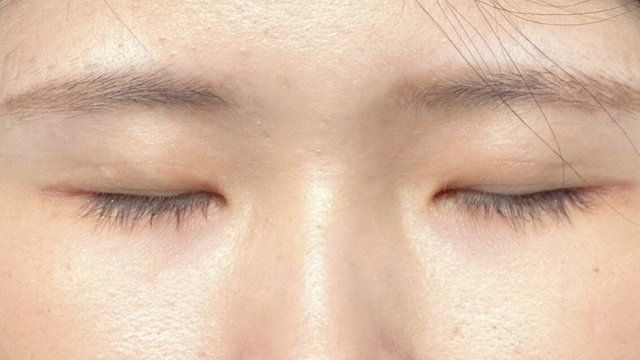 Postoperative Condition Part 1